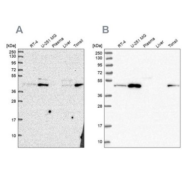 Anti-ZDHHC16 antibody produced in rabbit Prestige Antibodies&#174; Powered by Atlas Antibodies, affinity isolated antibody