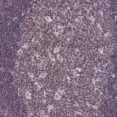 Anti-CDC7 antibody produced in rabbit Prestige Antibodies® Powered by Atlas Antibodies, affinity isolated antibody, buffered aqueous glycerol solution