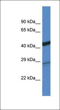 Anti-DGAT2 antibody produced in rabbit affinity isolated antibody