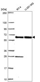 Anti-Eif2B4 Antibody Produced In Rabbit Prestige Antibodies® Powered by Atlas Antibodies, affinity isolated antibody, buffered aqueous glycerol solution