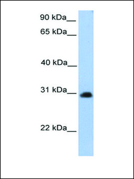 Anti-CHST14 antibody produced in rabbit affinity isolated antibody