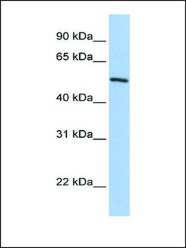 Anti-KLF11 antibody produced in rabbit affinity isolated antibody