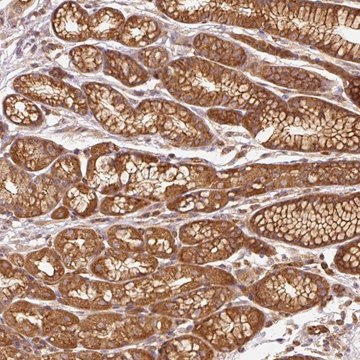 Anti-ADCY4 antibody produced in rabbit Prestige Antibodies&#174; Powered by Atlas Antibodies, affinity isolated antibody, buffered aqueous glycerol solution