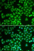 Anti-NFKB1 antibody produced in rabbit