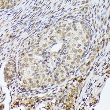 Anti-PSMD14 antibody produced in rabbit