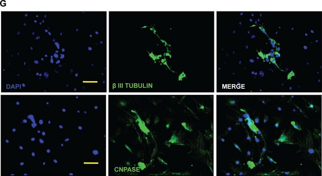 Anti-CNPase Antibody, clone 11-5B clone 11-5B, Chemicon&#174;, from mouse