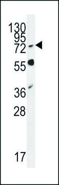 ANTI-RNF19B (CENTER) antibody produced in rabbit IgG fraction of antiserum, buffered aqueous solution