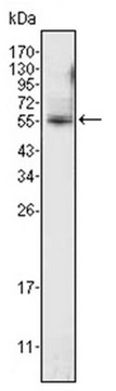 Anti-ETV4 Antibody, clone 1A2G3 ascites fluid, clone 1A2G3, from mouse