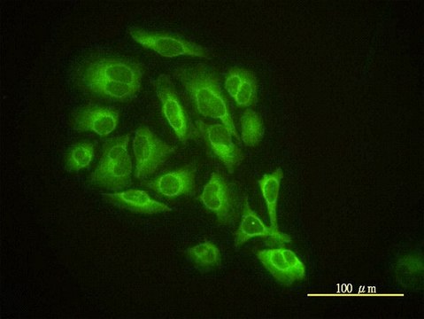 Monoclonal Anti-GMFB antibody produced in mouse clone 2G12-2A2, purified immunoglobulin, buffered aqueous solution