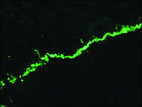 Anti-Collagen, Type VII antibody, Mouse monoclonal clone LH7.2, purified from hybridoma cell culture