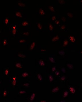 Anti-PAX6 antibody produced in rabbit