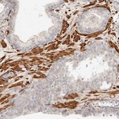 Anti-TMTC2 antibody produced in rabbit Prestige Antibodies® Powered by Atlas Antibodies, affinity isolated antibody, buffered aqueous glycerol solution, ab1