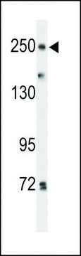 ANTI-PTPRD(N-TERMINAL) antibody produced in rabbit affinity isolated antibody, buffered aqueous solution