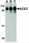 抗-ACE2 兔抗 affinity isolated antibody, buffered aqueous solution