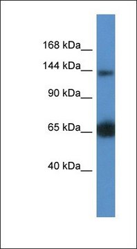 Anti-RAPGEF2 antibody produced in rabbit affinity isolated antibody