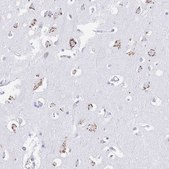 Anti-FAM3C antibody produced in rabbit Prestige Antibodies® Powered by Atlas Antibodies, affinity isolated antibody, buffered aqueous glycerol solution