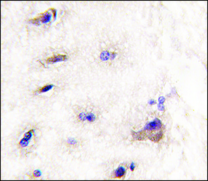 Anti-DDIT4 (C-term) antibody produced in rabbit Ig fraction of antiserum, buffered aqueous solution