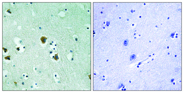 Anti-CRMP-2 antibody produced in rabbit affinity isolated antibody