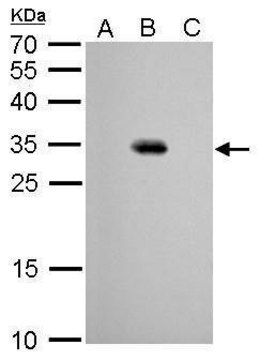 单克隆抗-GFP 小鼠抗 clone GT7312, affinity isolated antibody