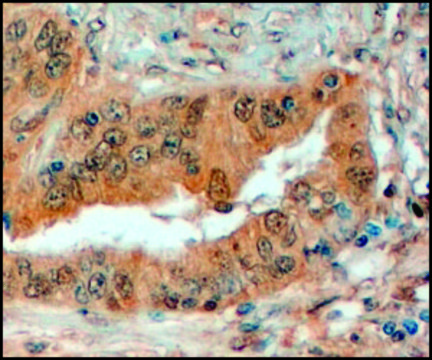 Anti-SEMA3E antibody produced in goat affinity isolated antibody, buffered aqueous solution