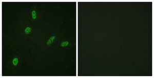 Anti-ETS1 antibody produced in rabbit affinity isolated antibody