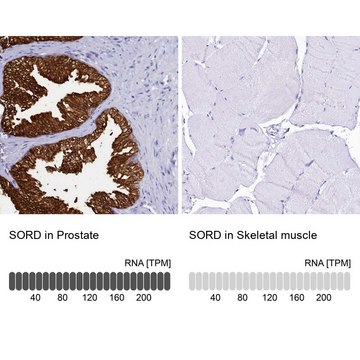 Anti-SORD antibody produced in rabbit Prestige Antibodies&#174; Powered by Atlas Antibodies, affinity isolated antibody, buffered aqueous glycerol solution