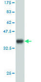ANTI-HTRA2 antibody produced in mouse clone 6H8, purified immunoglobulin, buffered aqueous solution