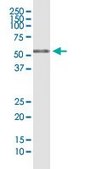 Monoclonal Anti-RIOK3 antibody produced in mouse clone 4A12-1D2, purified immunoglobulin, buffered aqueous solution
