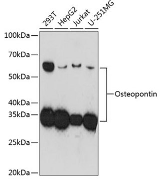 Anti-Osteopontin Antibody, clone 5E3A6, Rabbit Monoclonal