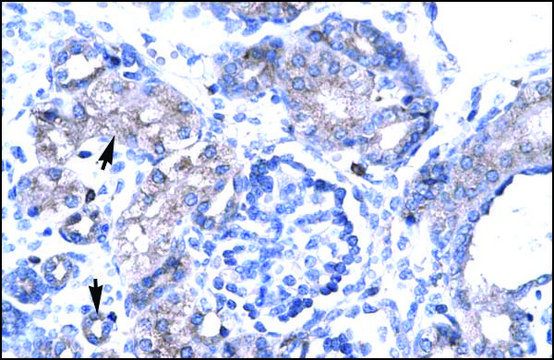 抗-TBX19 兔抗 IgG fraction of antiserum