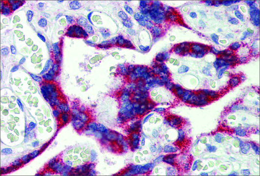 Anti-MKNK2 antibody produced in rabbit affinity isolated antibody