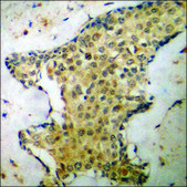 Anti-phospho-p70 S6 Kinase (pSer418) antibody produced in rabbit affinity isolated antibody