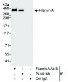 Rabbit anti-Filamin A Antibody, Affinity Purified Powered by Bethyl Laboratories, Inc.