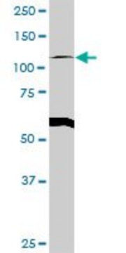 Anti-GART antibody produced in rabbit purified immunoglobulin, buffered aqueous solution