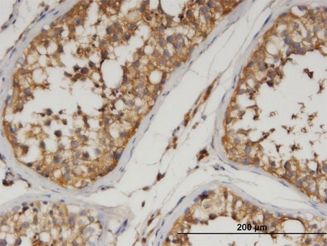 Monoclonal Anti-ANGPTL3, (C-terminal) antibody produced in mouse clone 3B7, purified immunoglobulin, buffered aqueous solution