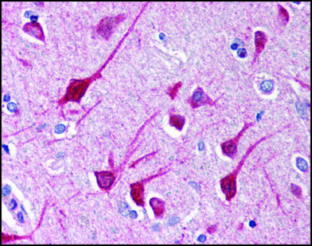 Anti-NLRP1 antibody produced in rabbit IgG fraction of antiserum, buffered aqueous solution