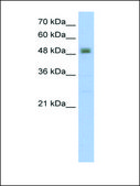 Anti-RSAD2 (AB2) antibody produced in rabbit IgG fraction of antiserum
