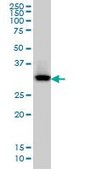 Monoclonal Anti-QPRT antibody produced in mouse clone 5D11, purified immunoglobulin, buffered aqueous solution