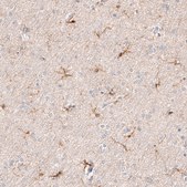 Monoclonal Anti-AIF1 antibody produced in mouse Prestige Antibodies® Powered by Atlas Antibodies, clone CL10930, purified antibody (Protein A)