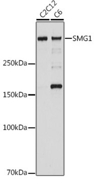 Anti-SMG1 Antibody, clone 5N10C7, Rabbit Monoclonal