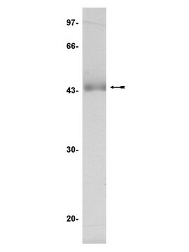 JNK1&#945;1/SAPK1c Protein, inactive, 50 g Unactive, N-terminal His6-tagged recombinant, human, full-length JNK1&#945;1/SAPK1c, for use in Kinase Assays.