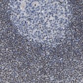 Anti-NOP58 antibody produced in rabbit Prestige Antibodies® Powered by Atlas Antibodies, affinity isolated antibody, buffered aqueous glycerol solution