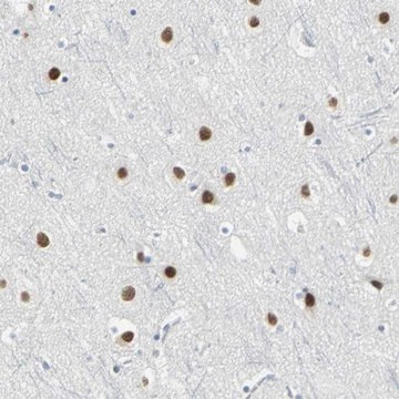 Anti-ZIC1 antibody produced in rabbit affinity isolated antibody, buffered aqueous glycerol solution