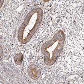 Anti-CAP1 antibody produced in rabbit Prestige Antibodies® Powered by Atlas Antibodies, affinity isolated antibody, buffered aqueous glycerol solution