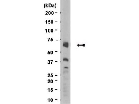 Anti-Progerin Antibody, clone 13A4 clone 13A4, Upstate&#174;, from mouse