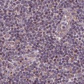 Anti-SUCLA2 antibody produced in rabbit Prestige Antibodies® Powered by Atlas Antibodies, affinity isolated antibody