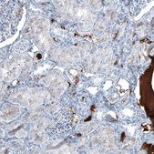 Monoclonal Anti-AFP antibody produced in mouse Prestige Antibodies® Powered by Atlas Antibodies, clone CL9766, purified immunoglobulin, buffered aqueous glycerol solution