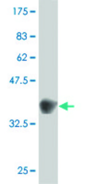 ANTI-GUCY2C antibody produced in mouse clone 3D5, purified immunoglobulin, buffered aqueous solution