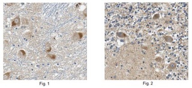 Anti-SQSTM1 Antibody, clone 20F1.1 clone 20F1.1, from mouse