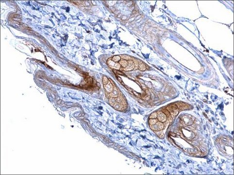 Anti-DSG2 (N-terminal) antibody produced in rabbit